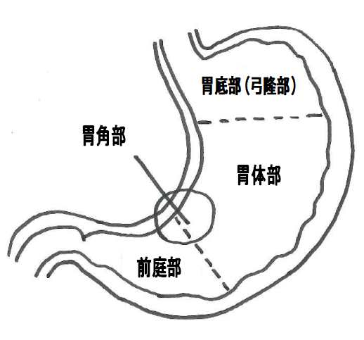 胃がん3.png